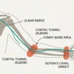 Ulnar nerve anatomy showing path through elbow and hand