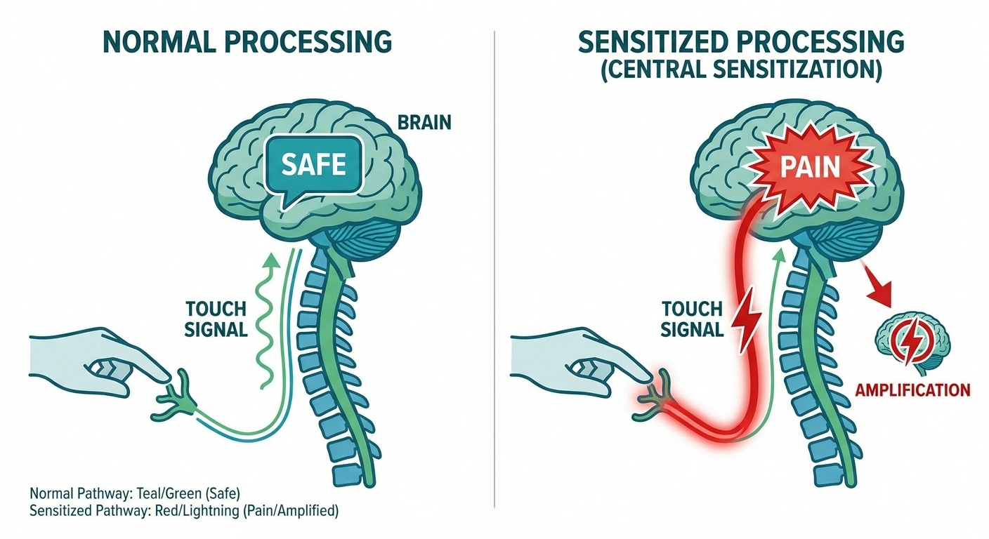Diagram illustrating how central sensitization in neuropathy causes normal touch signals to be processed as pain (allodynia)