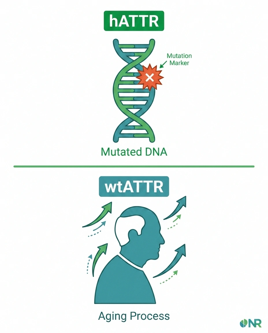 Diagram comparing hereditary ATTR and wild-type ATTR amyloidosis differences
