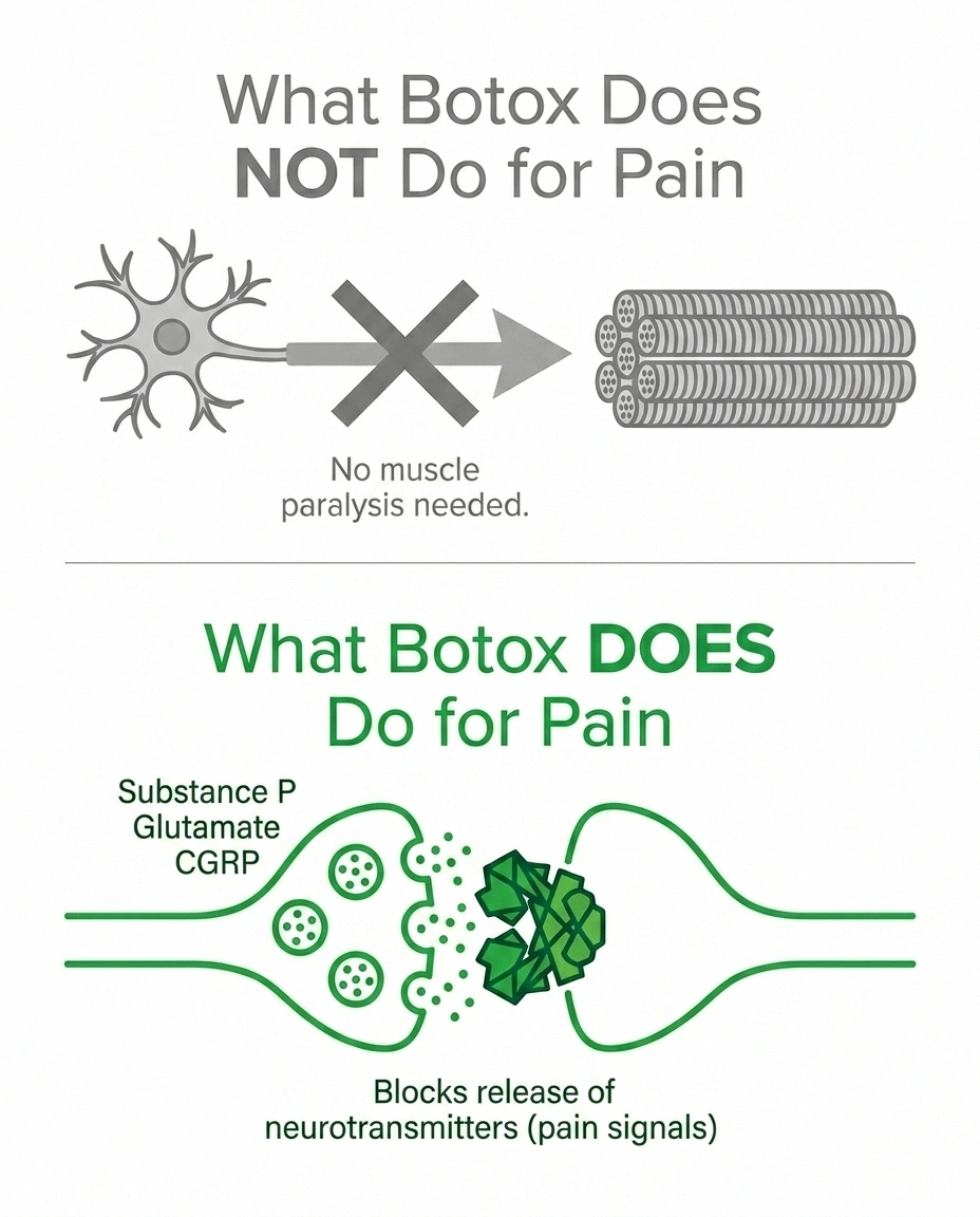 Diagram showing how botulinum toxin blocks pain mediators in sensory nerves independently of muscle effect
