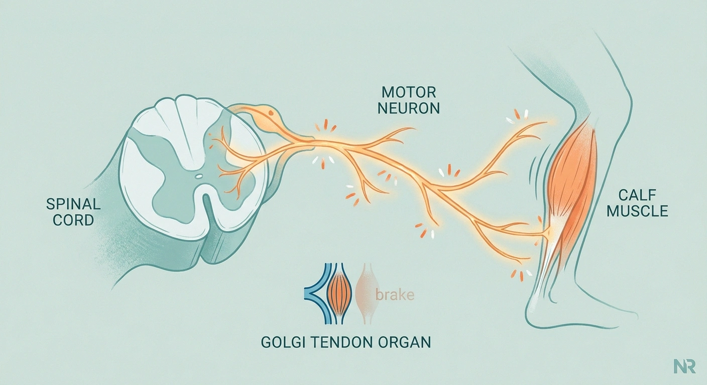 Medical illustration of a hyperexcitable motor neuron firing abnormally and causing a calf muscle to contract — the proposed mechanism behind neuropathy cramps.