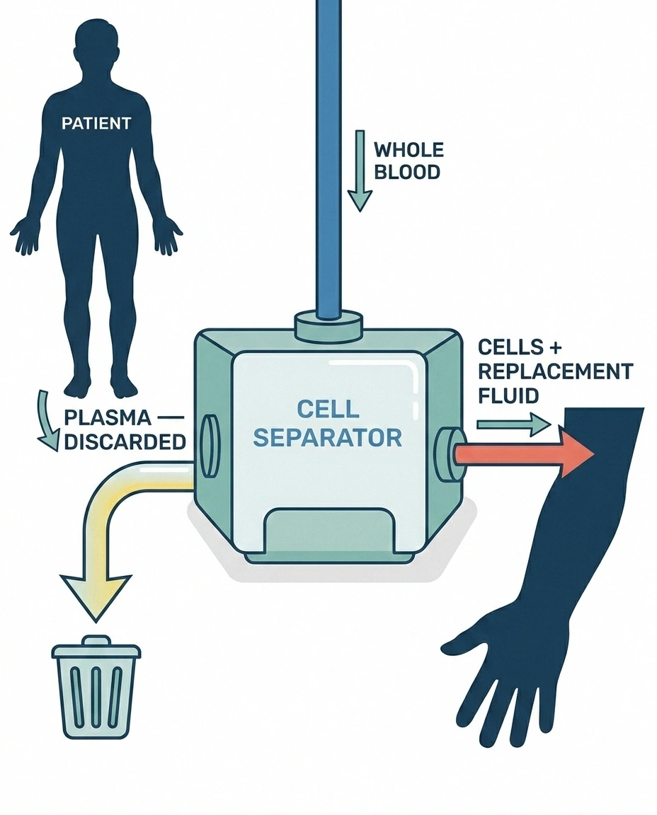 Diagram of a cell separator machine separating plasma from blood cells during therapeutic plasma exchange
