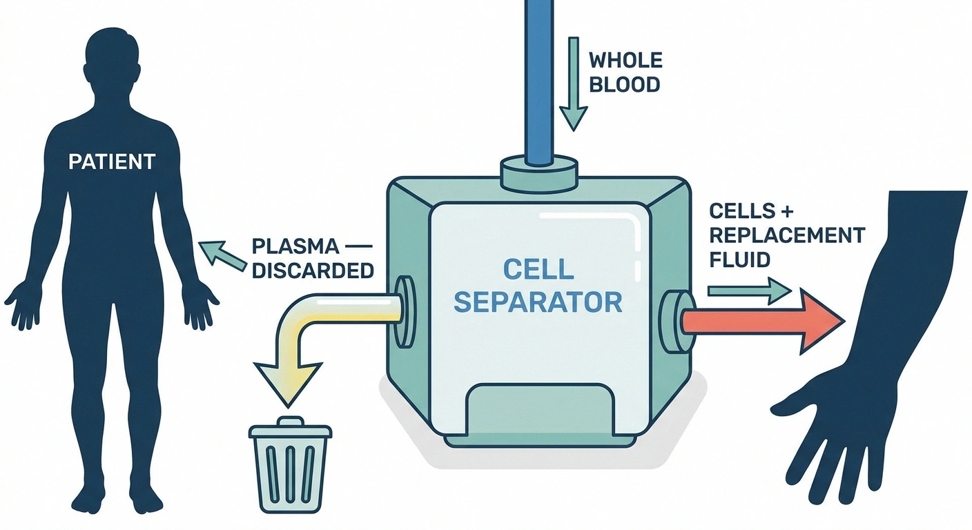 Diagram of a cell separator machine separating plasma from blood cells during therapeutic plasma exchange