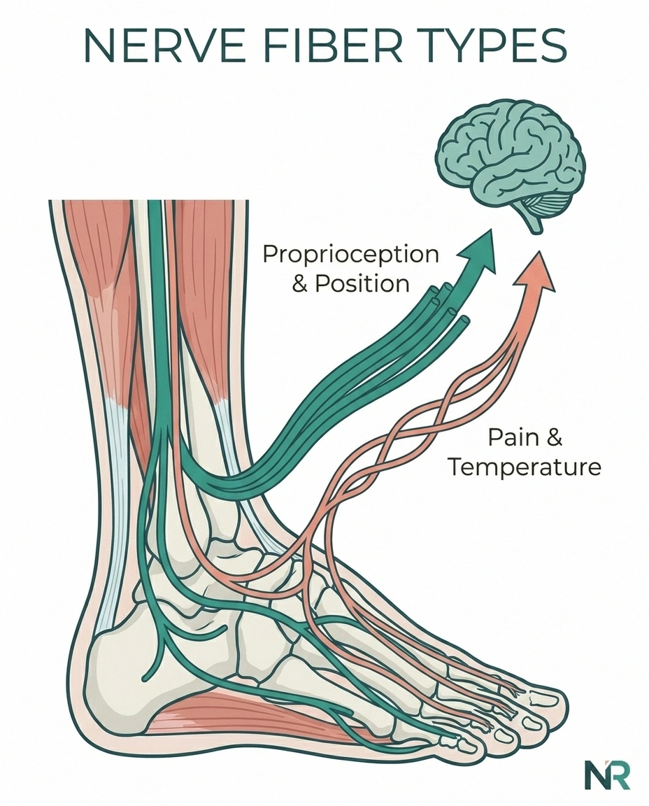 Diagram showing large-fiber and small-fiber nerve pathways in neuropathy — proprioception travels through large fibers