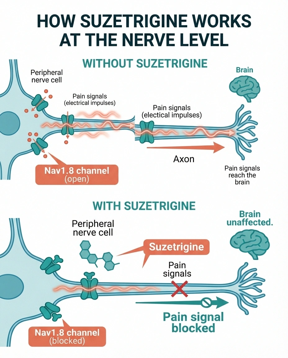 Diagram showing how suzetrigine blocks Nav1.8 sodium channels in peripheral nerves to stop pain signals before they reach the brain