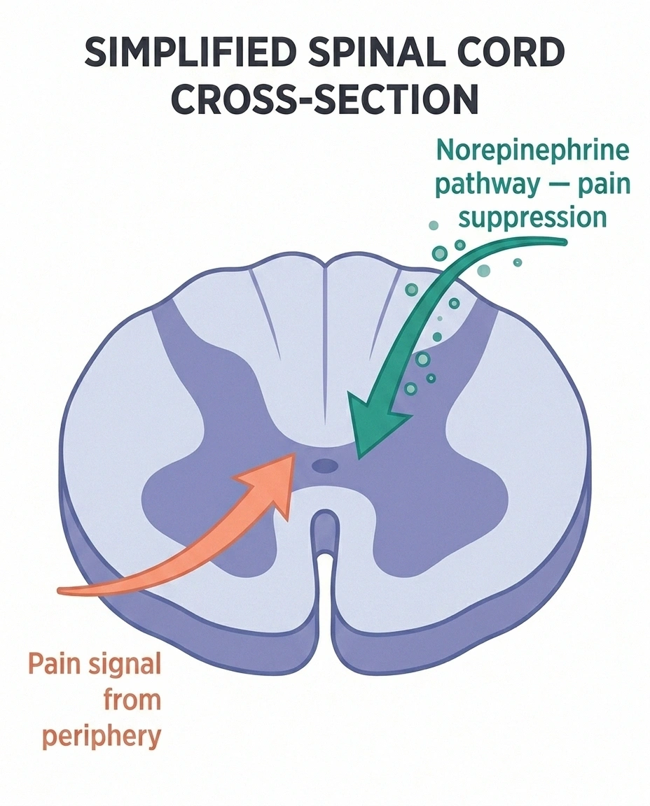 Diagram of descending pain inhibition — how norepinephrine from venlafaxine suppresses neuropathic pain signals