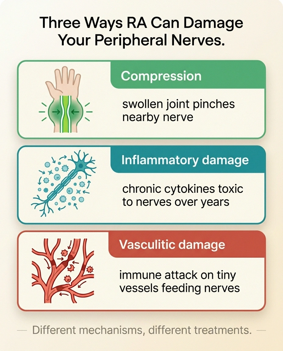 Infographic comparing three mechanisms of RA nerve damage: compression, inflammatory polyneuropathy, vasculitic neuropathy