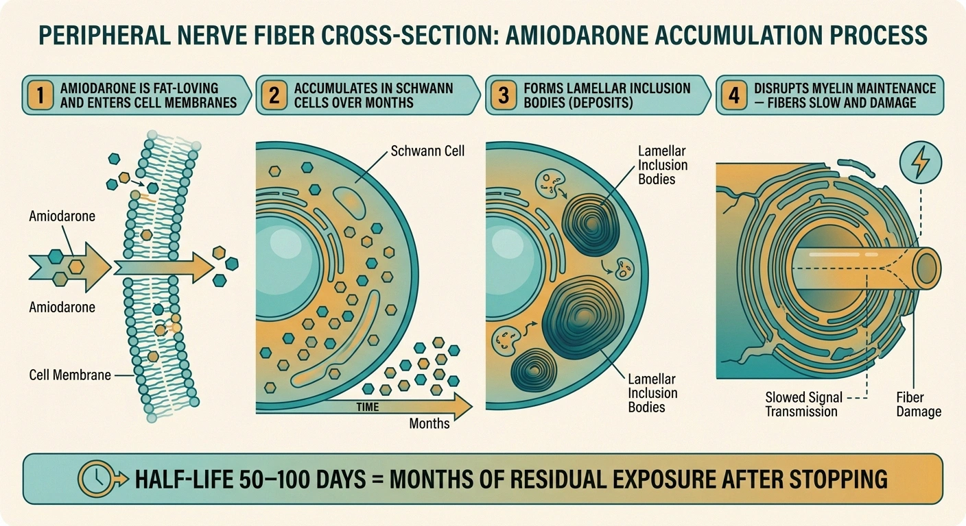 Four-step infographic showing how amiodarone accumulates in Schwann cells and forms lamellar inclusion bodies that disrupt myelin in peripheral nerves