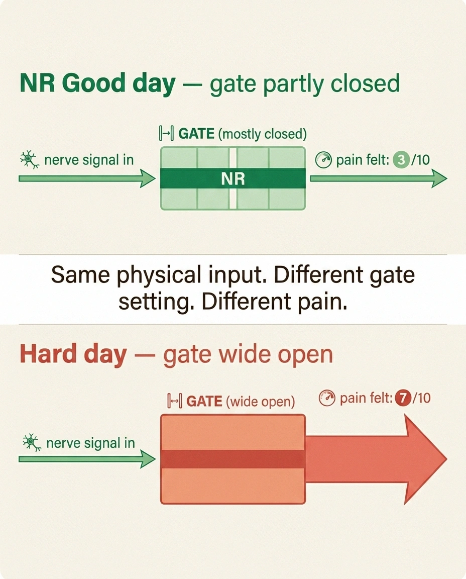 Two-panel infographic showing how the same nerve damage produces 3/10 pain when the gate is partly closed and 7/10 when wide open