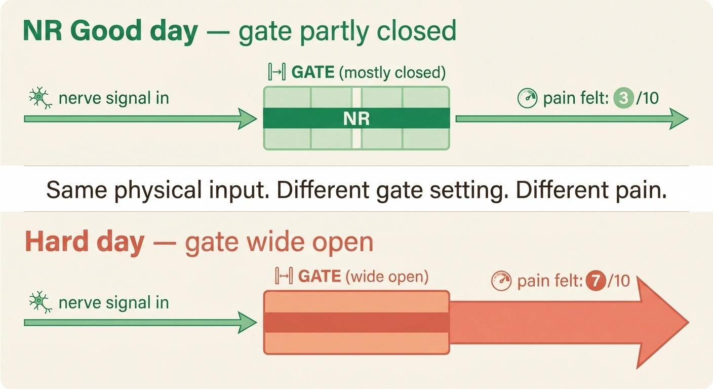 Two-panel infographic showing how the same nerve damage produces 3/10 pain when the gate is partly closed and 7/10 when wide open