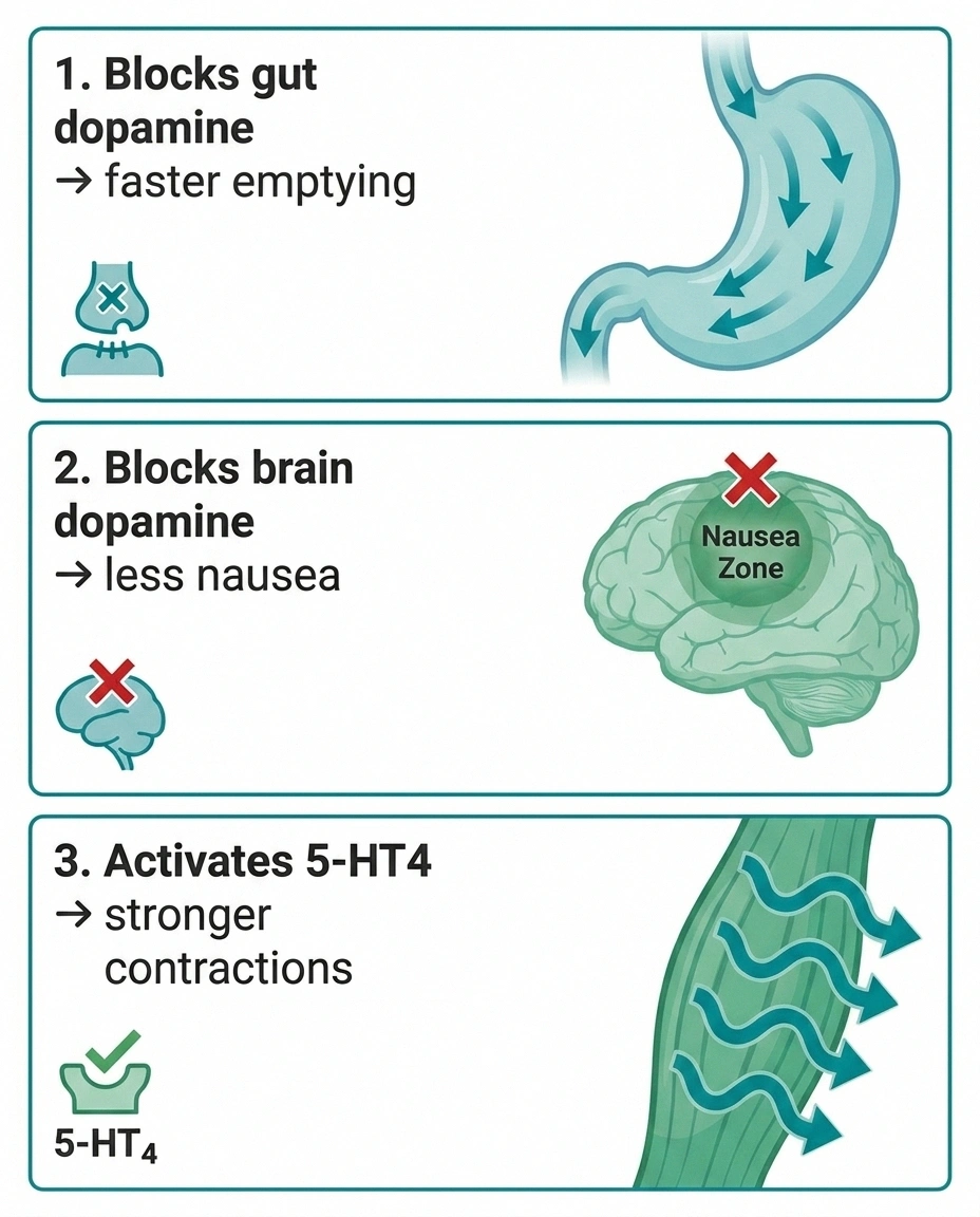 Three mechanisms of metoclopramide for gastroparesis — gut dopamine, brain dopamine, serotonin 5-HT4