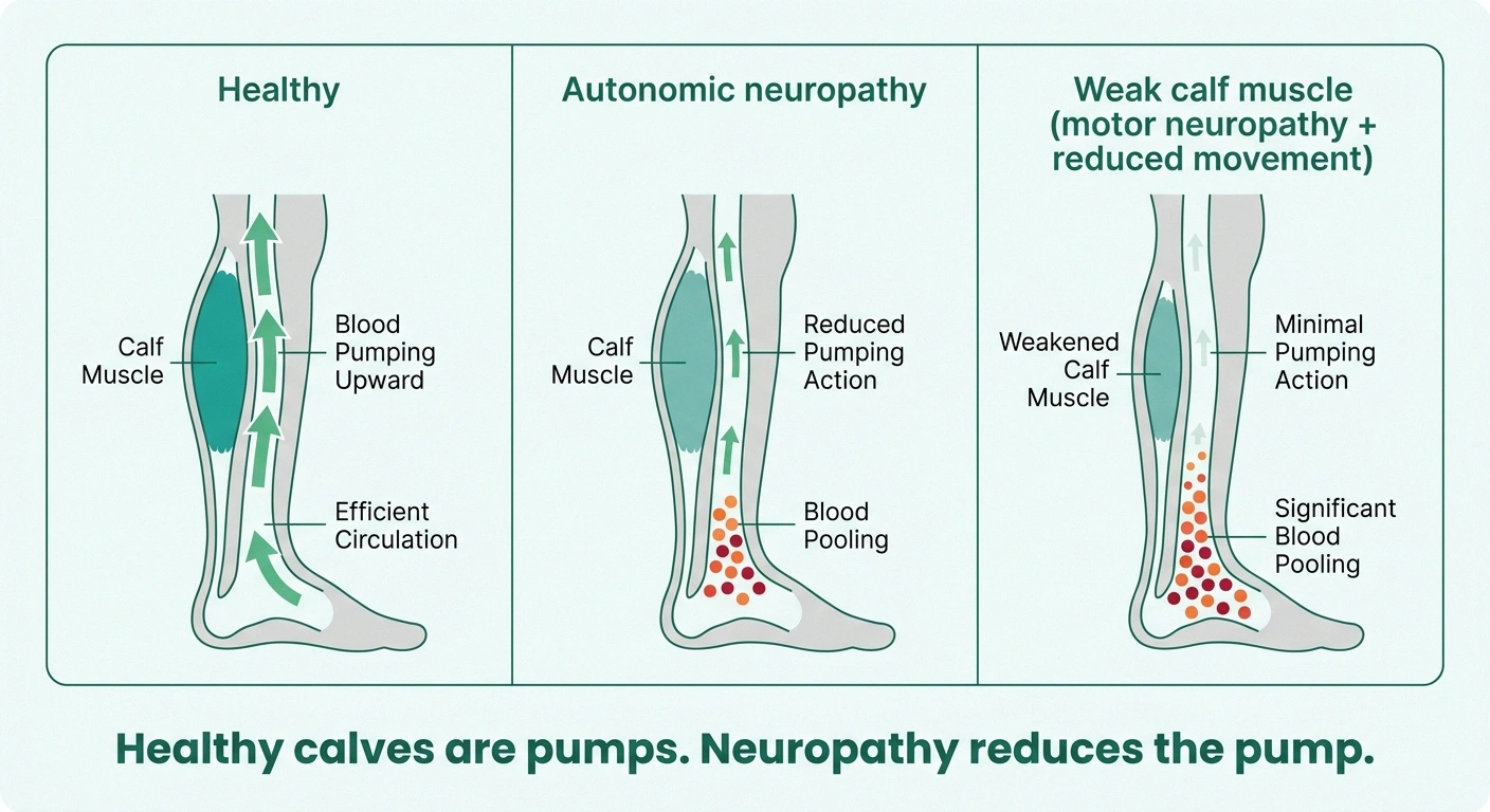 Infographic showing how autonomic neuropathy and weakened calf muscles reduce venous return and allow fluid to pool in the ankles.