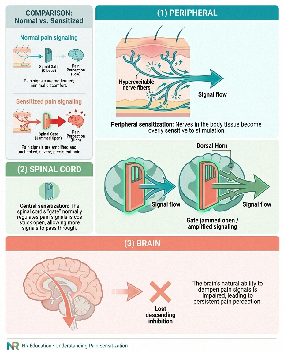 Infographic showing the three sites of pain sensitization in chronic neuropathy — peripheral nerve fibers, spinal cord dorsal horn, and brain.