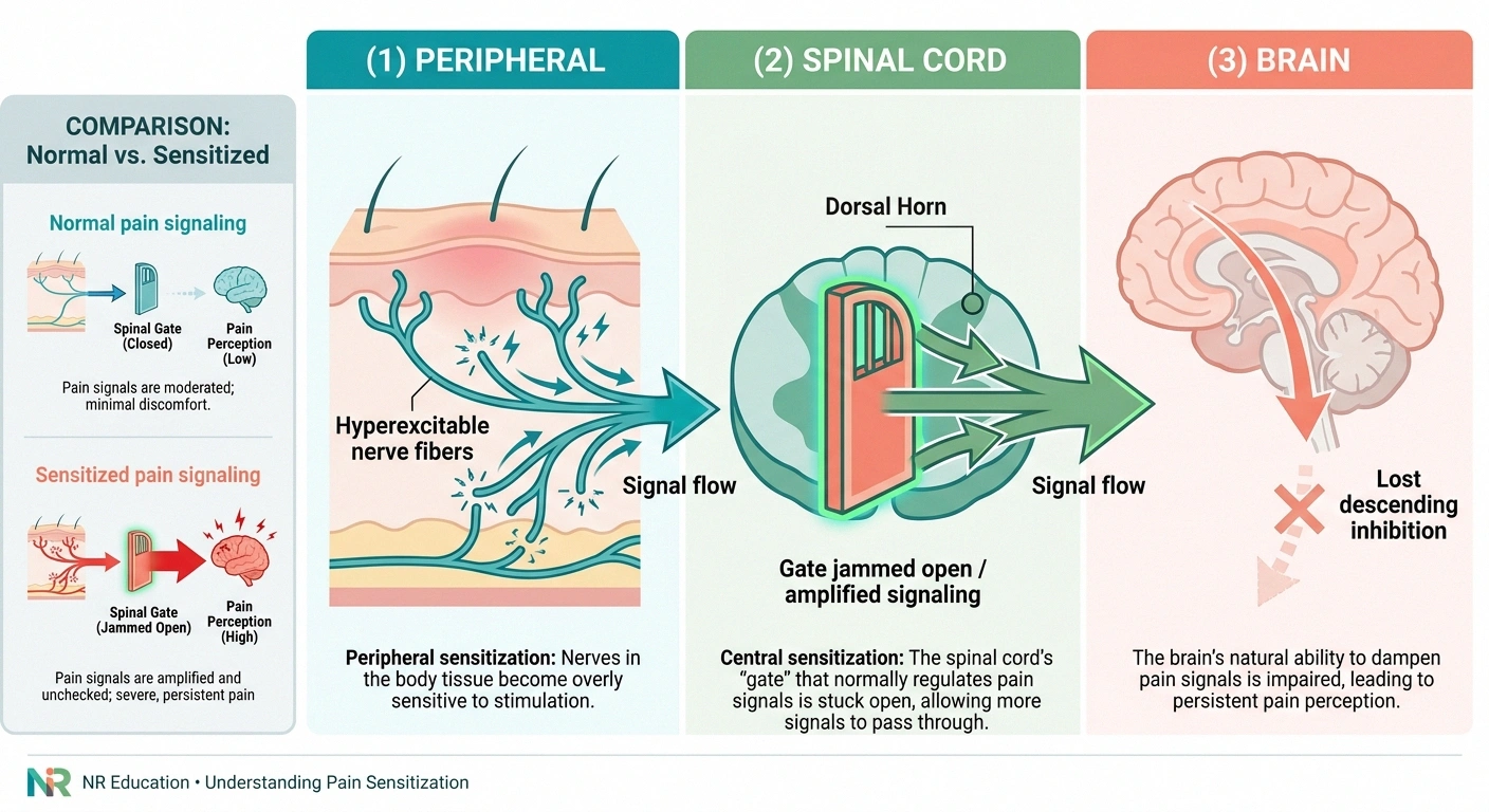 Infographic showing the three sites of pain sensitization in chronic neuropathy — peripheral nerve fibers, spinal cord dorsal horn, and brain.