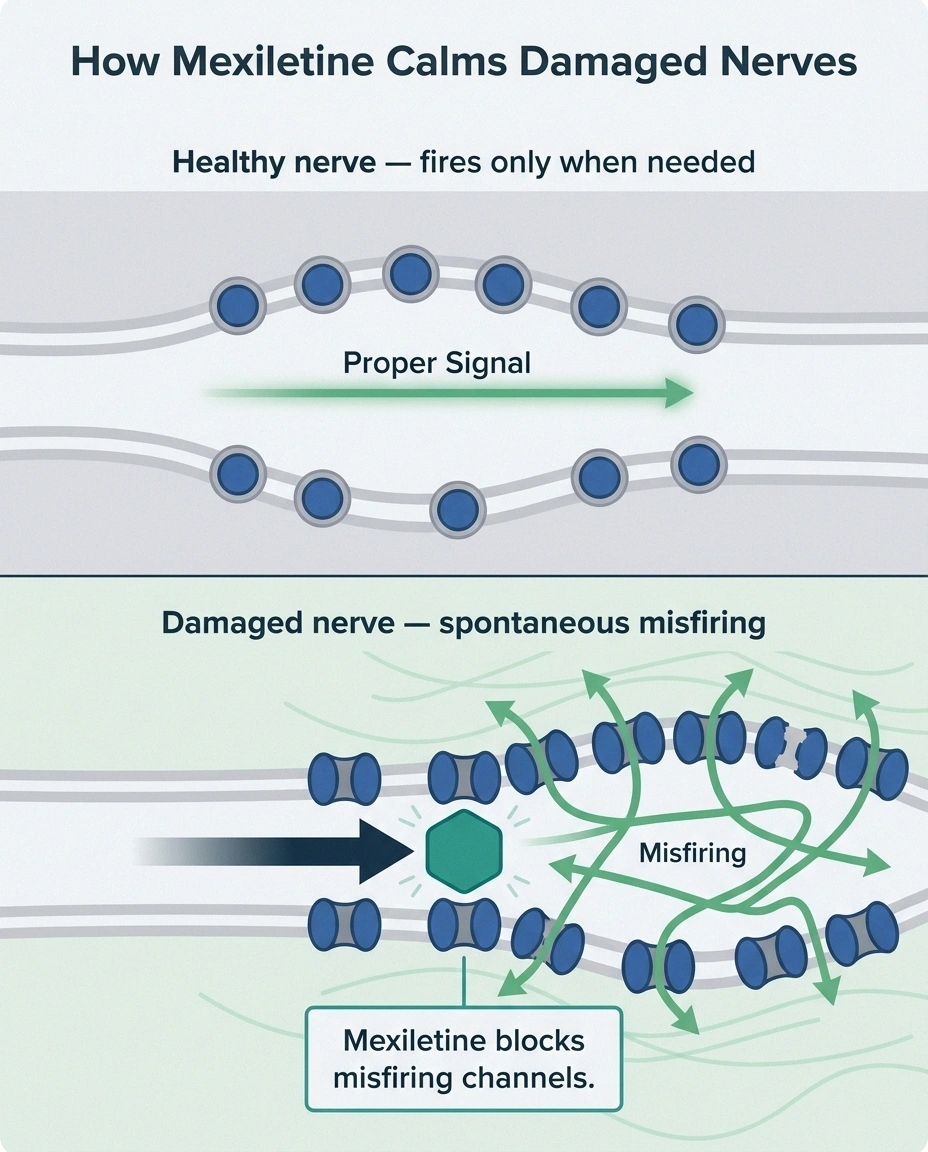 Medical illustration showing mexiletine blocking voltage-gated sodium channels in damaged peripheral nerves