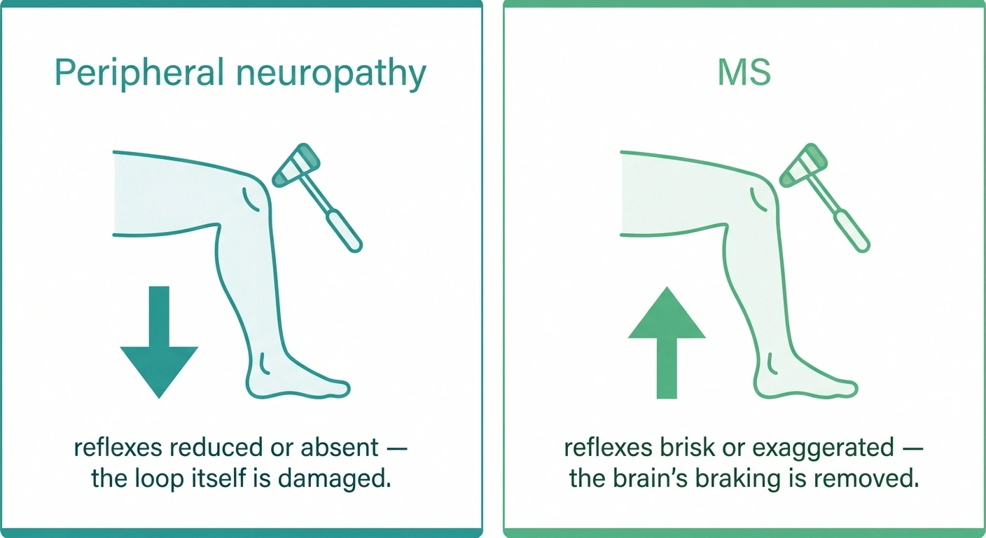 Two-panel infographic showing reflexes decrease in peripheral neuropathy and increase in multiple sclerosis when tested with the same reflex hammer.