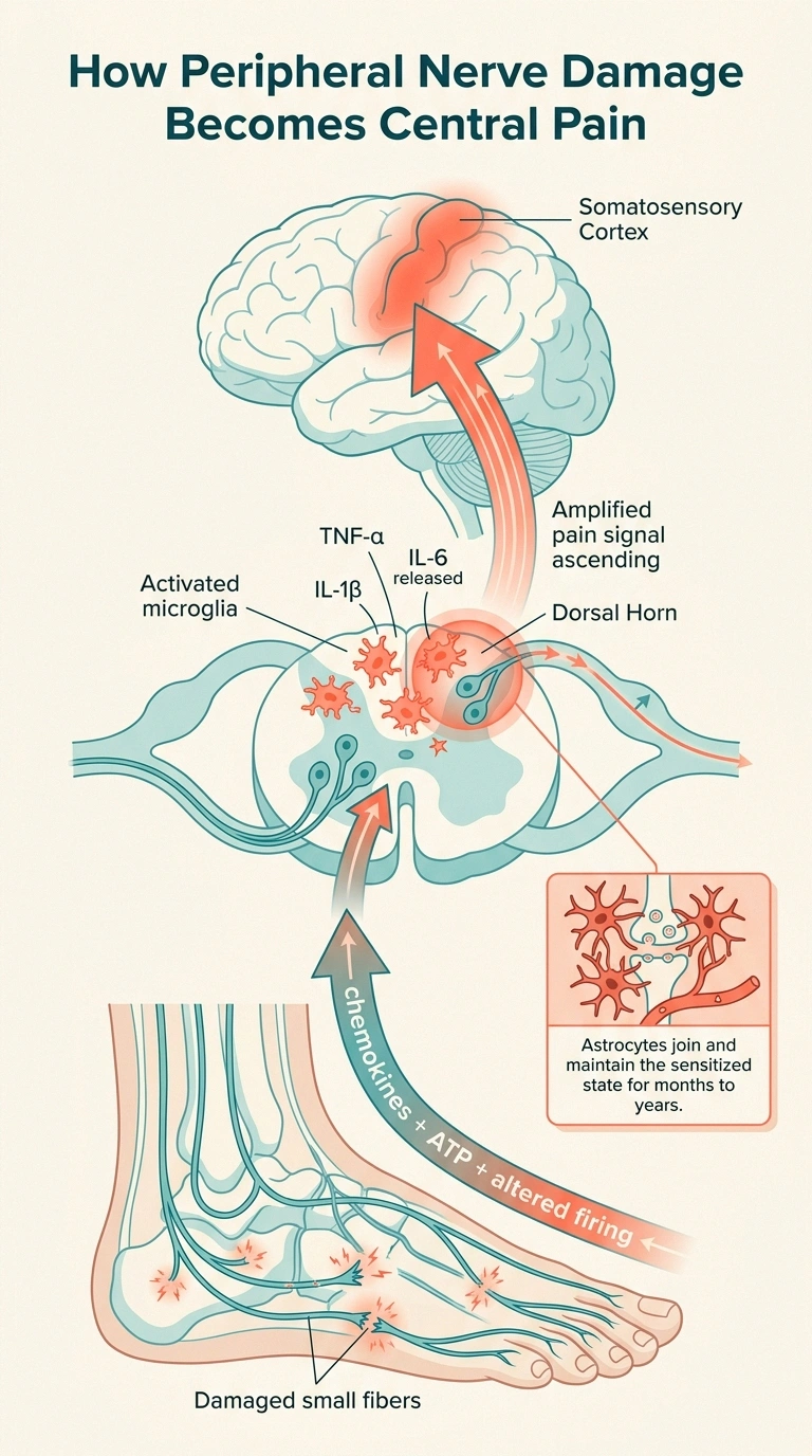 A vertical infographic showing peripheral nerve damage in the foot sending signals up to activated microglia in the spinal cord dorsal horn, which then send amplified pain signals to the brain.
