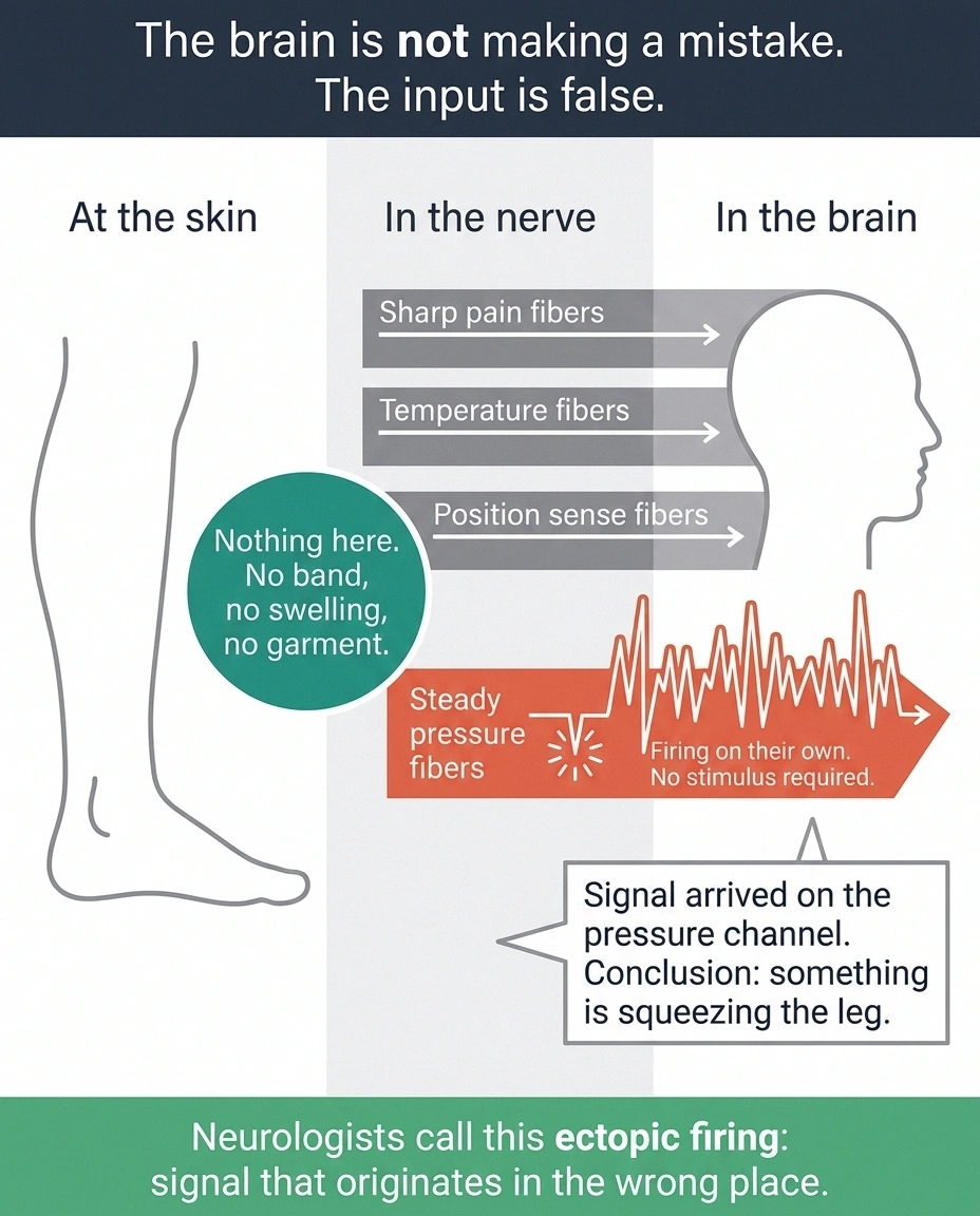 Diagram showing pressure nerve fibers firing without any stimulus at the skin