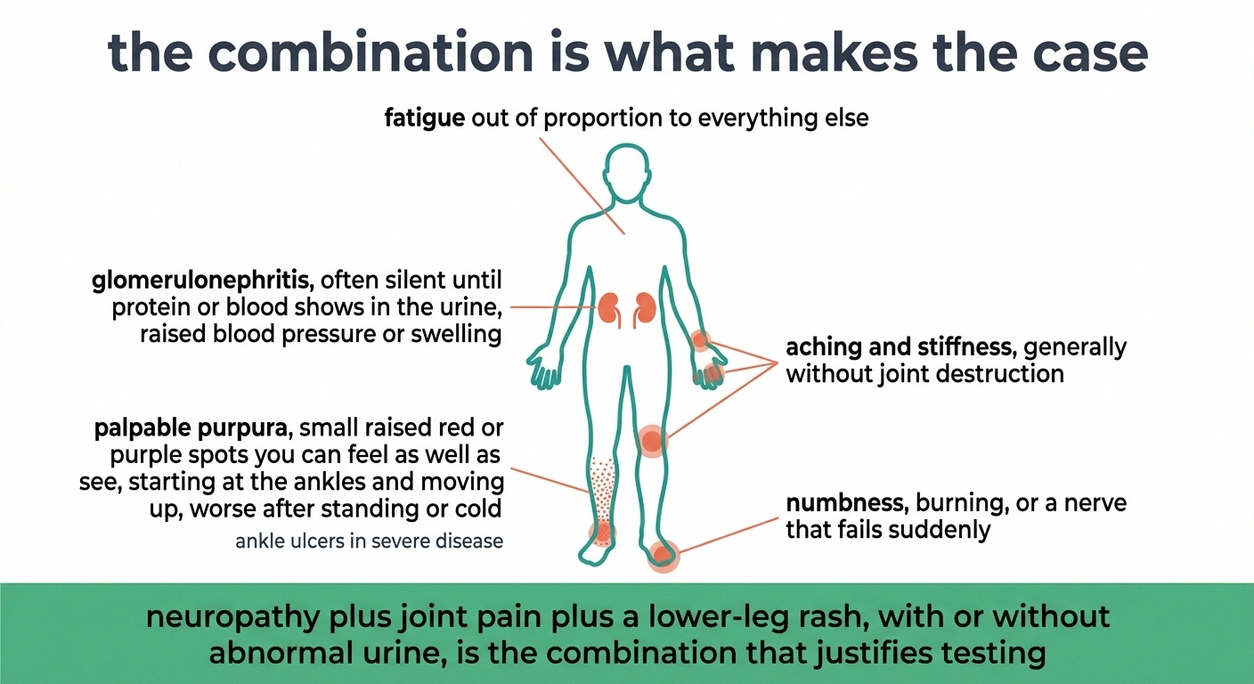 Body map of cryoglobulinemia signs across skin, joints, kidneys and nerves.