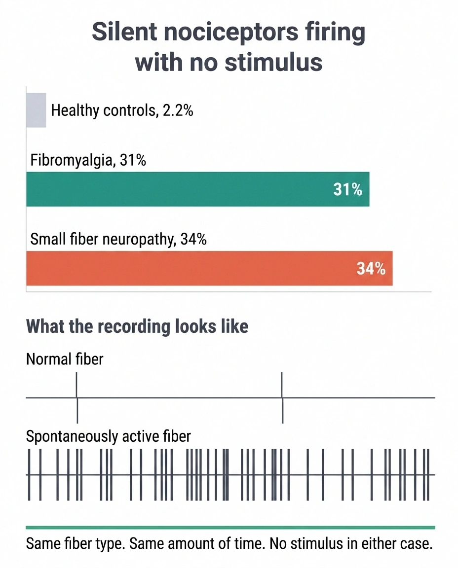 Bar chart showing 34 percent spontaneous firing in small fiber neuropathy versus 2.2 percent in controls