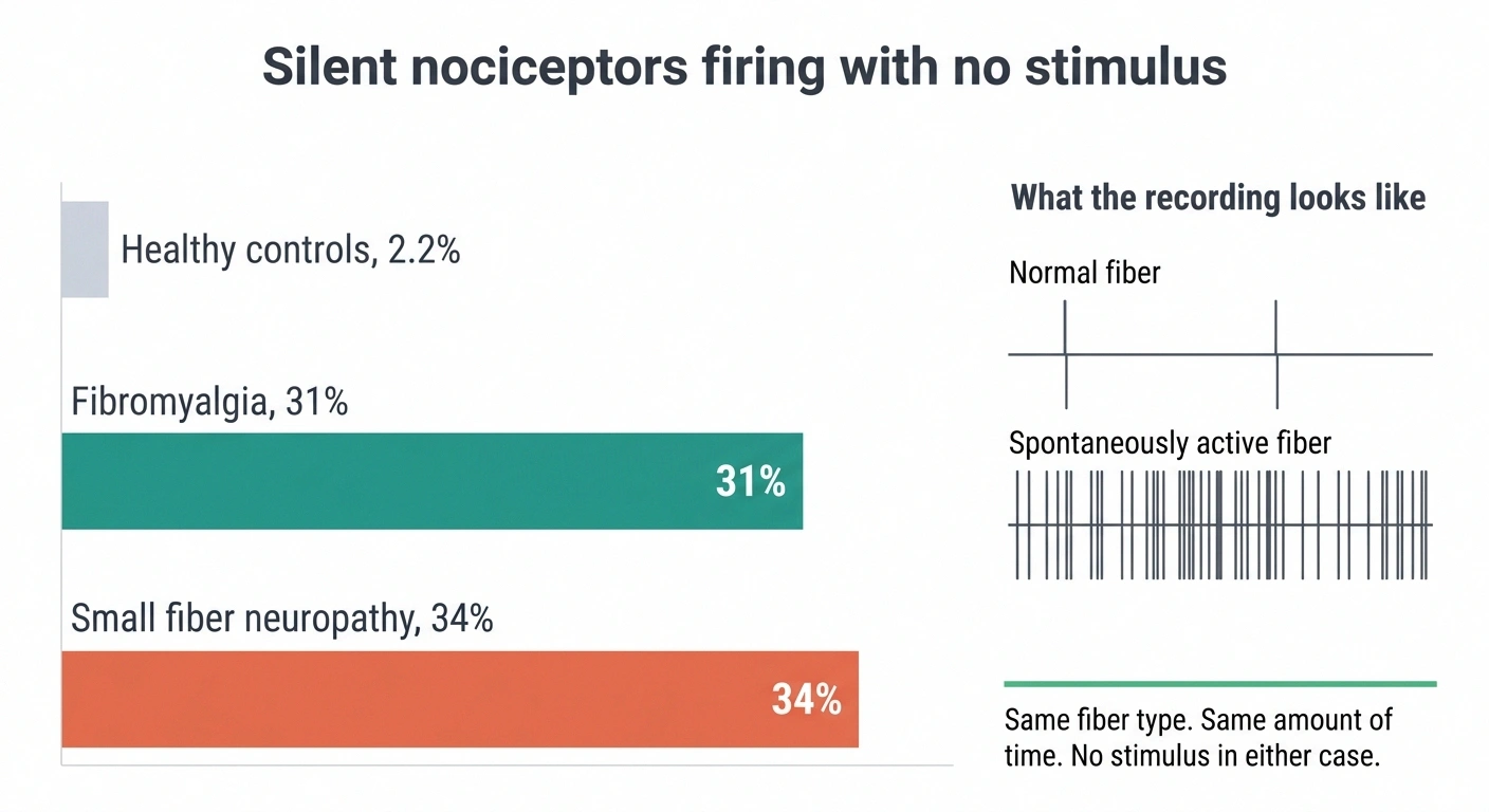 Bar chart showing 34 percent spontaneous firing in small fiber neuropathy versus 2.2 percent in controls