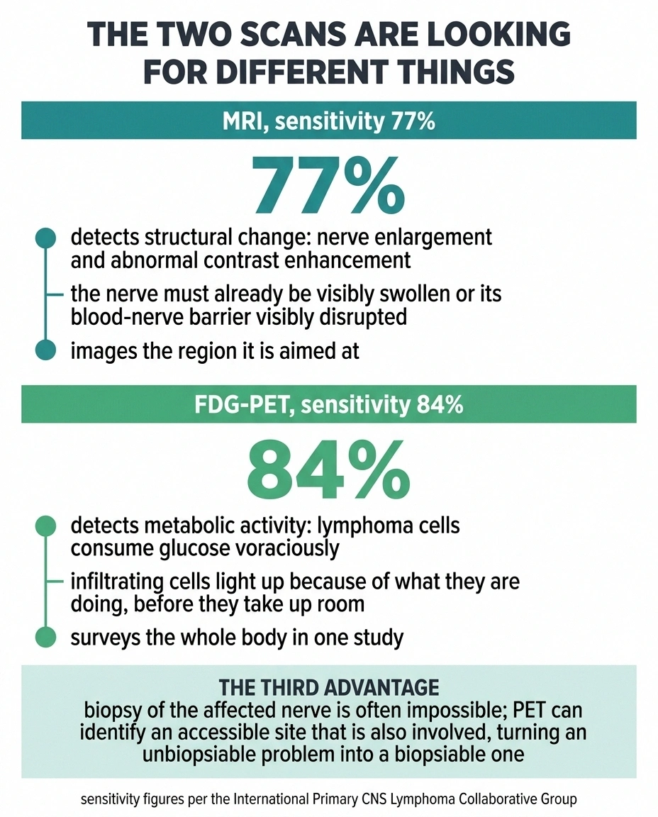 Comparison chart showing FDG-PET at 84 percent sensitivity against MRI at 77 percent and what each detects.