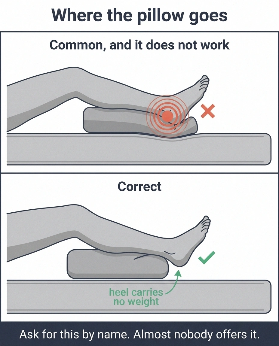 Diagram comparing pillow under the heel versus under the calf to offload heels