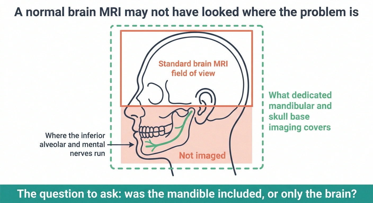 Diagram showing a standard brain MRI field of view stopping above the jaw where the nerve runs