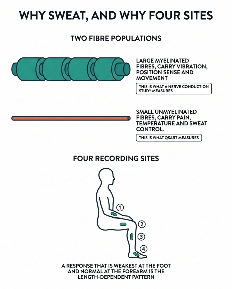 Diagram comparing large and small nerve fibres beside the four QSART recording sites.
