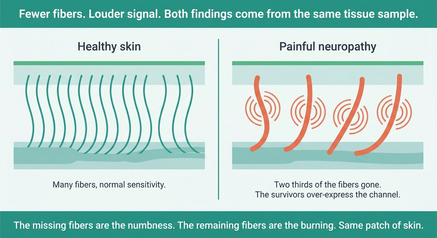 Two-panel diagram comparing many normal nerve fibers with fewer amplified fibers