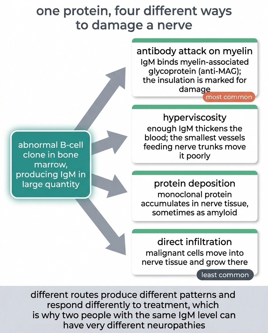 Diagram showing four routes by which IgM damages nerves in Waldenstrom macroglobulinemia.