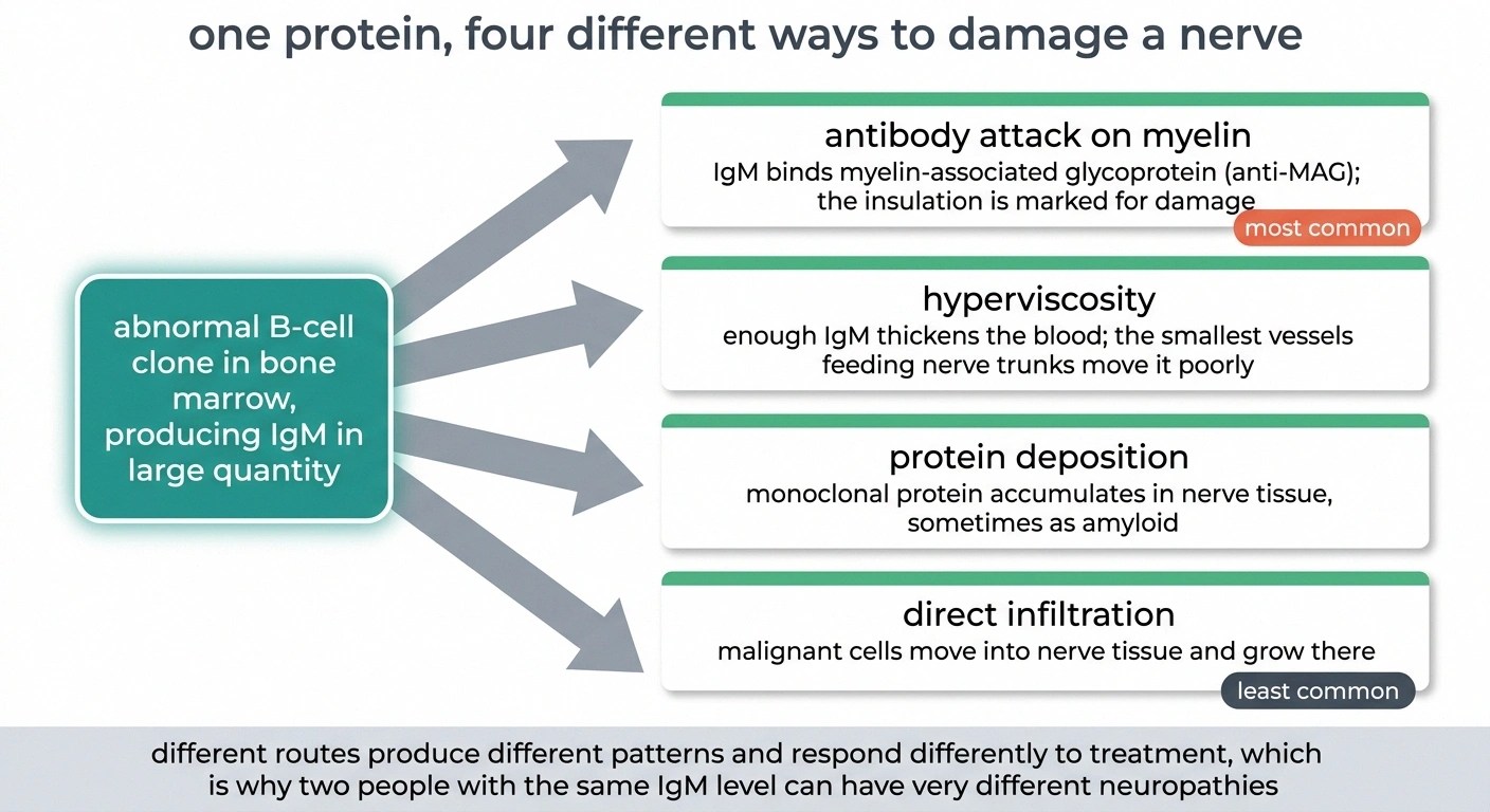 Diagram showing four routes by which IgM damages nerves in Waldenstrom macroglobulinemia.